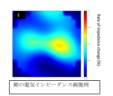 電気インピーダンス画像例