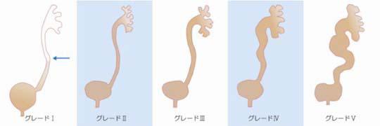 ti_1110_11.jpg 図