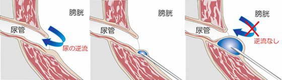 ti_1110_13.jpg 図