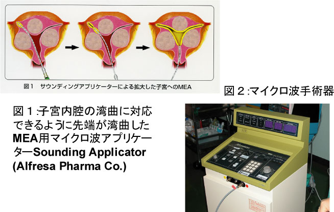 ti_mea0907.jpg MEAの実際