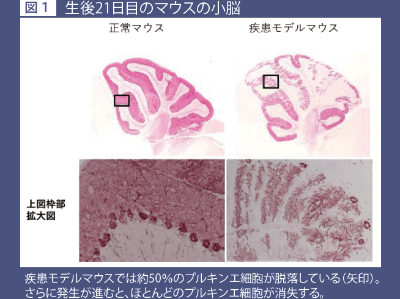 プルキンエ細胞 プルキンエ細胞